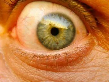 ageing eyes tend to yellow because of ultraviolet light and dust exposure