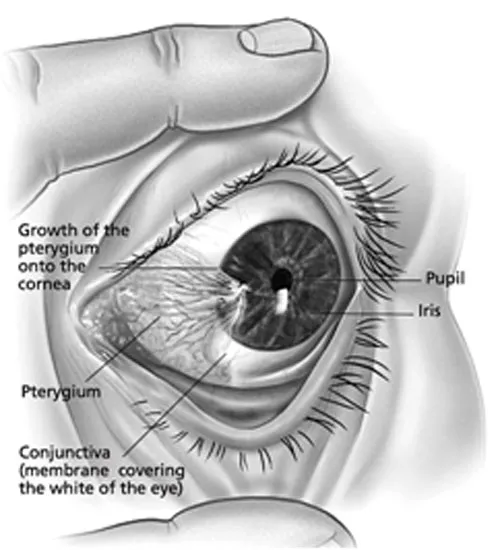 Golden Eyes Subliminal: Extremely Powerful Biokinesis to Get