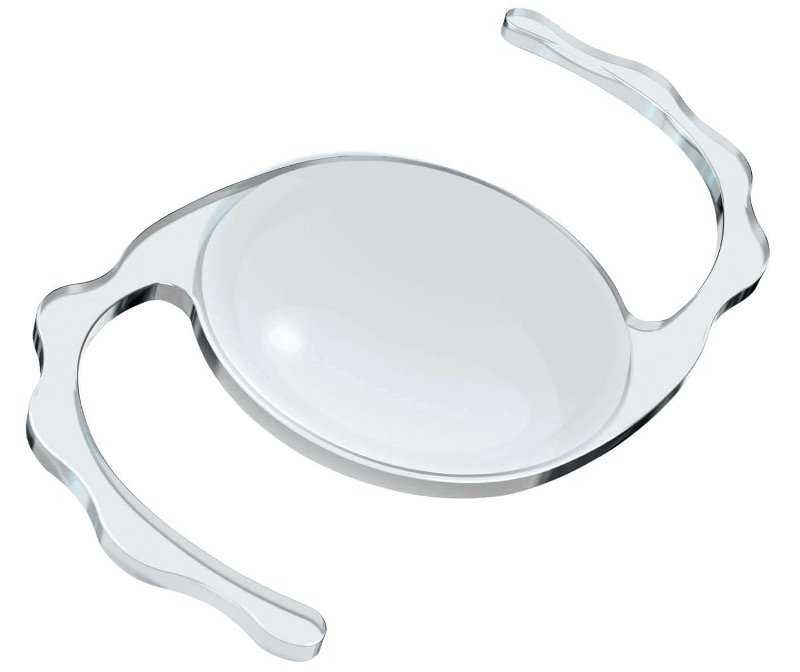 Correction Of Imperfect Cataract Surgery correction-of-imperfect-cataract-surgery